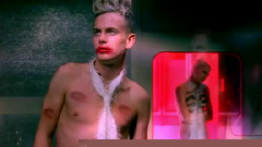 Placebo - Bruise Pristine