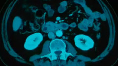 电影<美错>预告片