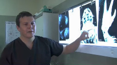 影视原声 - 电影<第九区>花絮之Doctor Exoskeleton