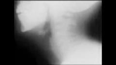 Nine Inch Nails - Right Where It Belongs