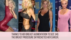 BOTCHED! Plastic Surgery Fails That Ruined Celebrities