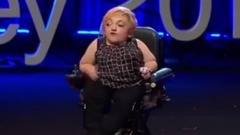 TED假肢女孩不想做励志偶像